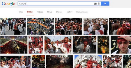 Do the blue eyes people have double vision problem?