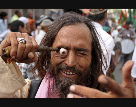 Do the blue eyes people have double vision problem?